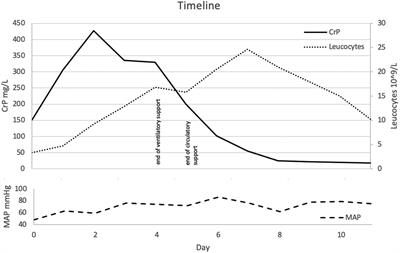 Case Report: MDFIC gene mutation resulting in central conducting lymphatic anomaly facilitates group A Streptococcus sepsis